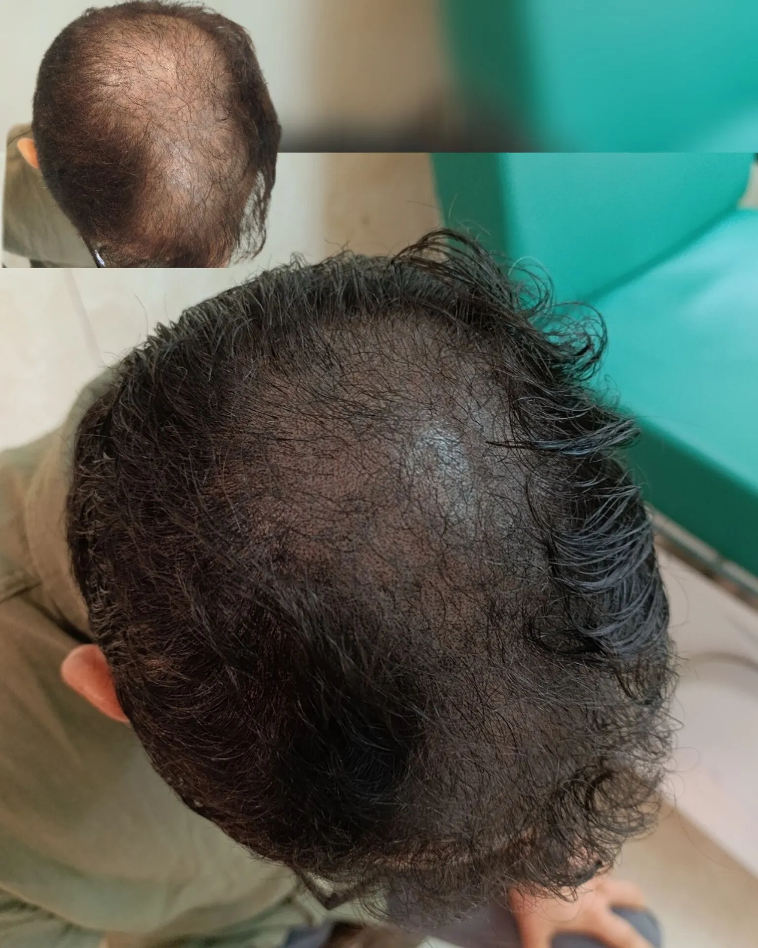 نمونه میکرواسکالپ